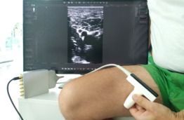 ThrombUS+ Horizon EU Project Initiates Clinical Trials