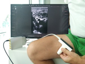 ThrombUS+ Initiates Clinical Trials